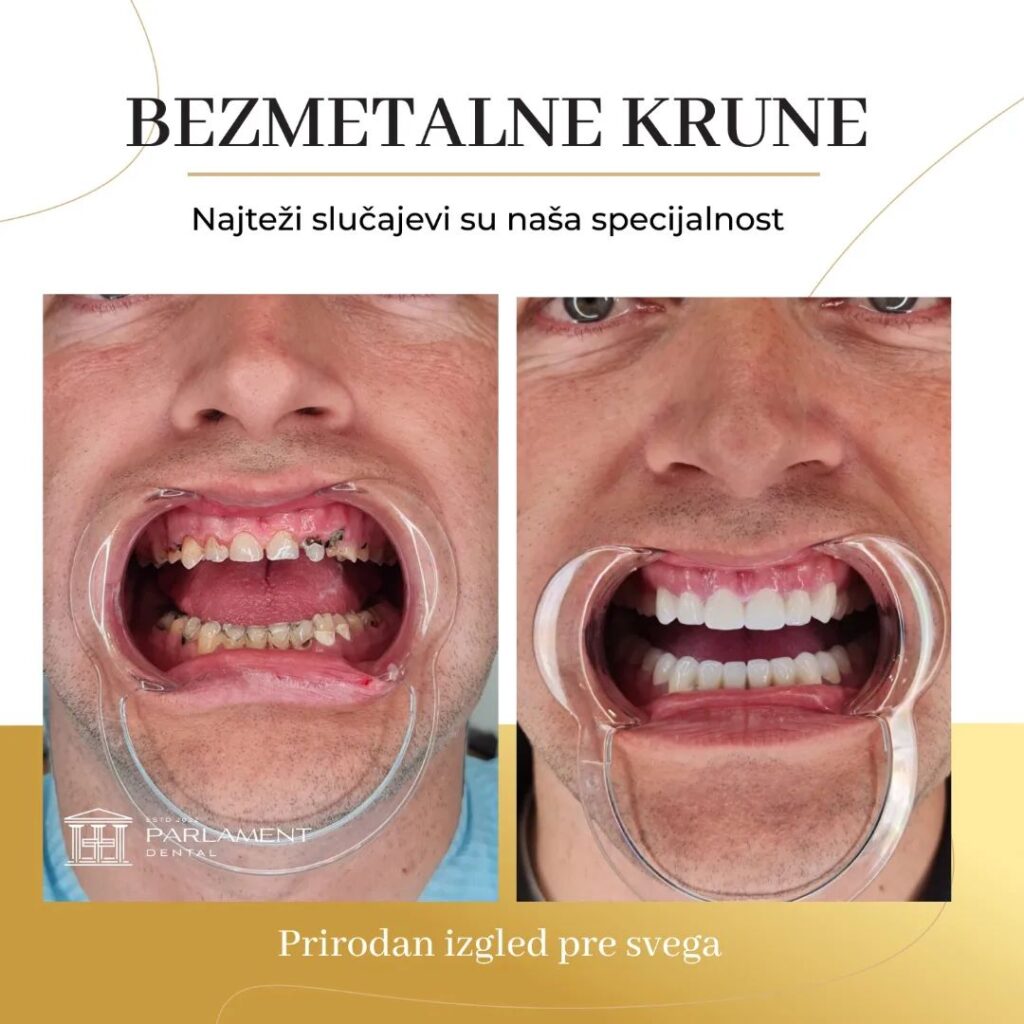parlament dental pre i posle